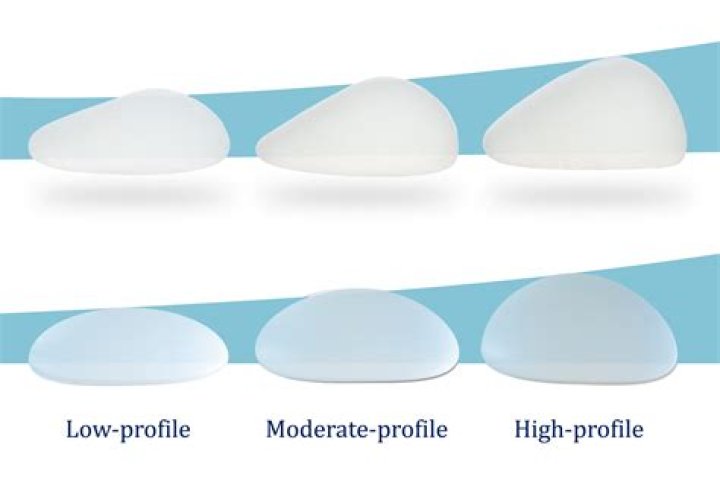 Bianca Censori Breast Implants: The Journey, Impact, and Expert Insights