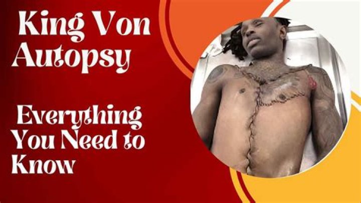 King Von Autopsy Report: The Untold Truth Behind the Legend's Passing