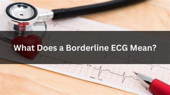 Understanding Borderline ECG: A Comprehensive Guide for Better Heart Health
